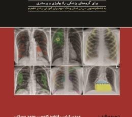 تفسیر رادیوگرافی قفسه سینه