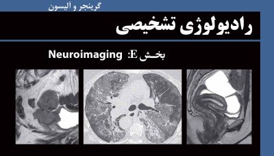 رادیولوژی تشخیصی گرینجر و آلیسون ویرایش هفتم 2021 - بخش E