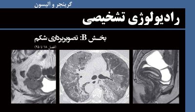رادیولوژی تشخیصی گرینجر و آلیسون ویرایش هفتم 2021 - بخش B