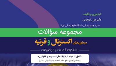 مجموعه سوالات گلوکوم (QBO)