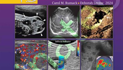 سونوگرافی تشخیصی رومک 2024 ، جلد 2