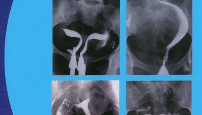A Textbook and Atlas of Hysterosalpingography Second Edition (هیستروسالپنگوگرافی)