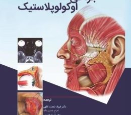 جراحی اوکولوپلاستیک