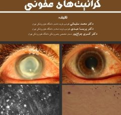 کراتیت های عفونی