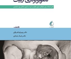 مروری سریع بر تصویربرداری اربیت