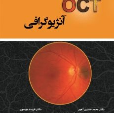 OCT آنژیوگرافی