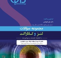 مجموعه سؤالات لنز و کاتاراکت (QBO)