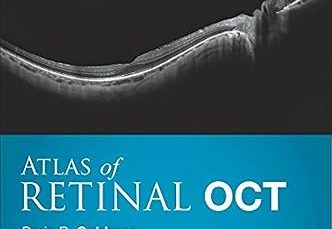 Atlas of Retinal OCT: Optical Coherence Tomography 1st 2018