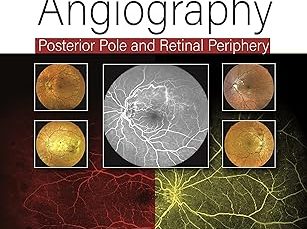 Practical Handbook of Fluorescein Angiography: Posterior Pole and Retinal Periphery 2nd Edition