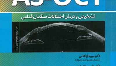AS-OCT تشخیص و درمان اختلالات سگمان قدامی